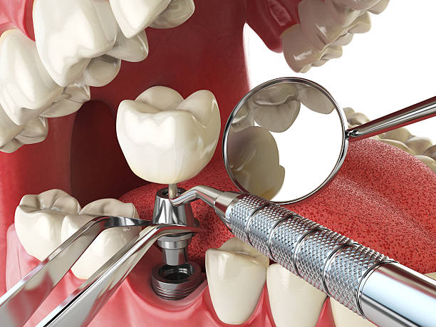 Best Weekend Emergency Dental Services in Perry, MI